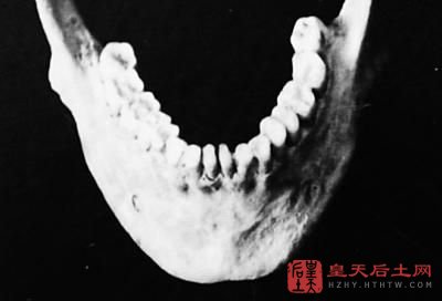 墓葬群中出土的人骨竖牙。刘春阳摄 